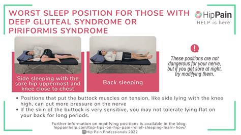 What Causes Hip Pain When Sleeping On Your Side at Ann Romero blog