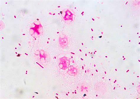 Haemophilus influenzae〔インフルエンザ桿菌〕 | グラム染色: Gram Stain