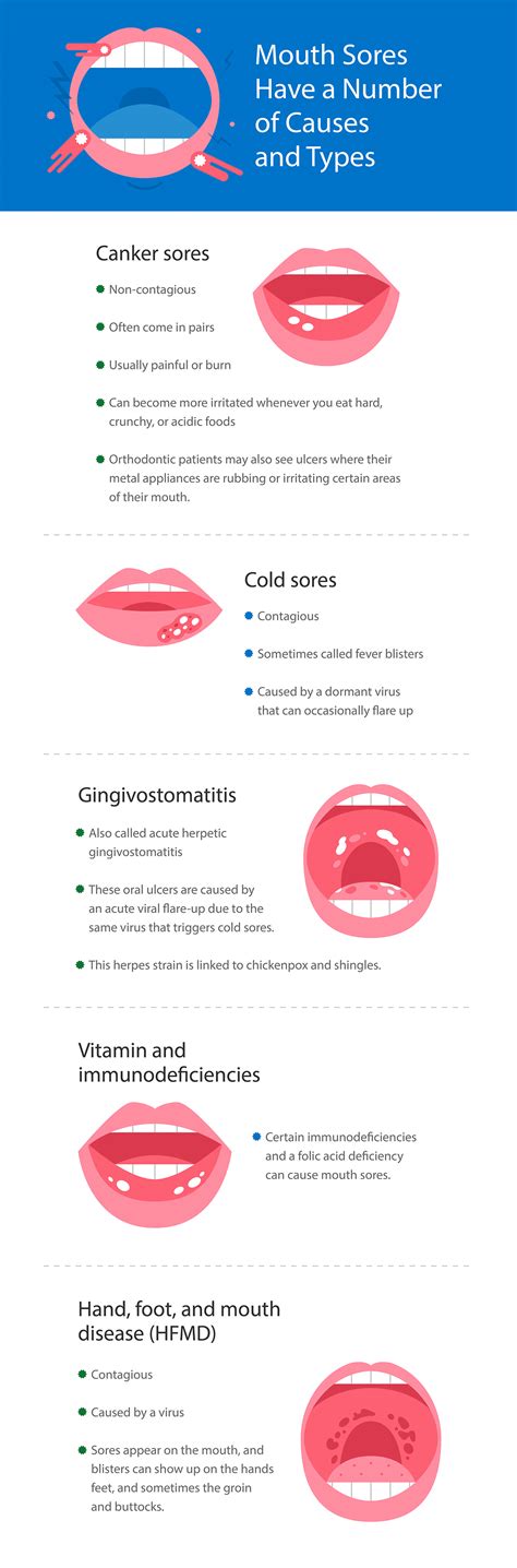 Cold Sores Vs Canker Sores Canker Sore Vs. Cancer | Smiles Dental