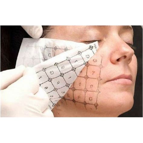 Jual KERTAS RF MARKING PAPER KHUSUS BUAT LASER FRAXEL,FRAKSI,RF DAN CO2 ...