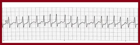 Image result for Solving Routine ND Non-Routine
