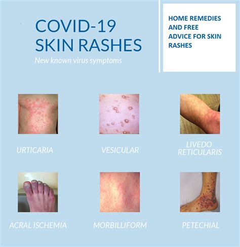 Causes Of Skin Rashes Without Itching at Darren Pennington blog