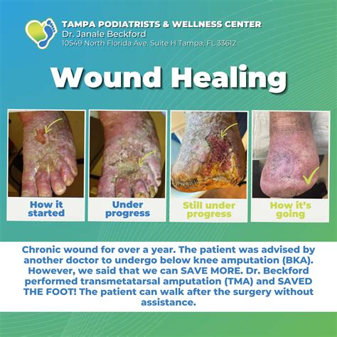 Wound Care - Tampa Podiatrists