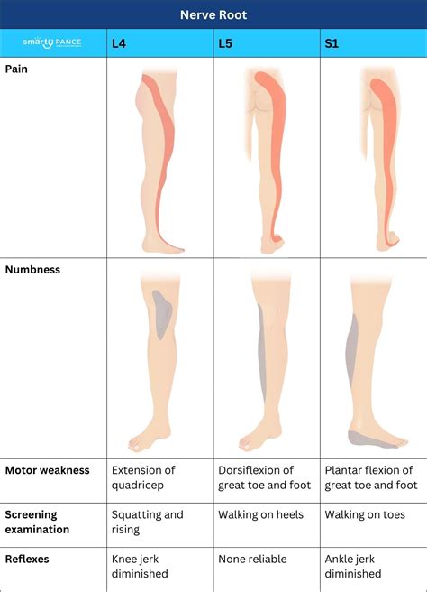 Radiculopathy Rapid Review: Cervical and Lumbar Patterns - Smarty PANCE