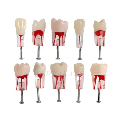 Dental RCT Root Canal Practice, Teaching, Study Teeth Model, fits Typodont Model NISSIN 200 Type ...