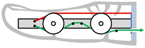 Karla: A Simple and Affordable 3-D Printed Body-Powered Prosthetic Hand ...