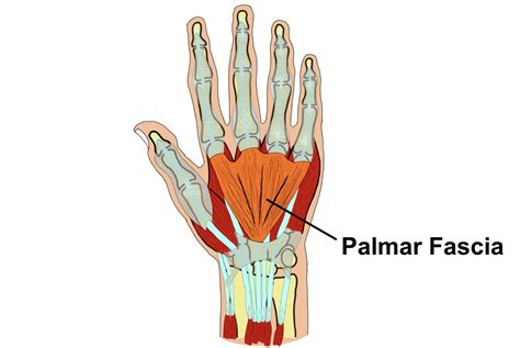 Physio MSK: Dupuytren's Disease