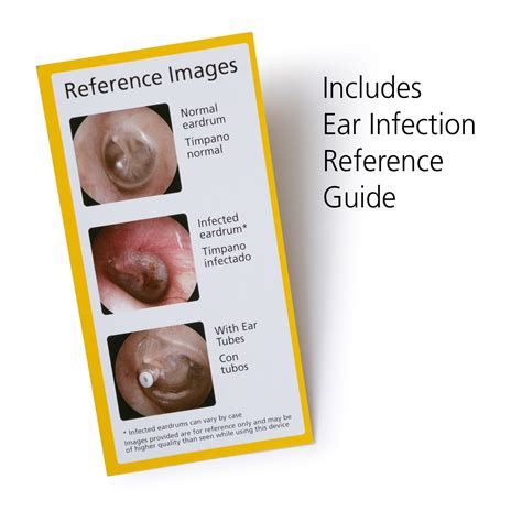 Otoscope View Ear Infection