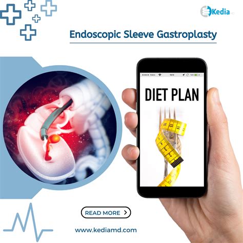 Endoscopic Sleeve Gastroplasty Post Surgery Diet at Wendell Espinoza blog