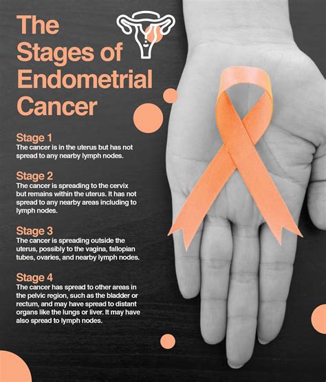 Stage 4 Endometriosis Cancer Symptoms