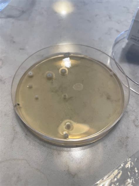 mold armour petri dish mold growth : r/Mold