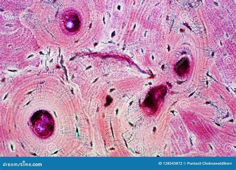 Histology of Human Compact Bone Tissue Under Microscope View for Stock ...