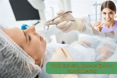 Recovery for Tooth Extraction 的图像结果