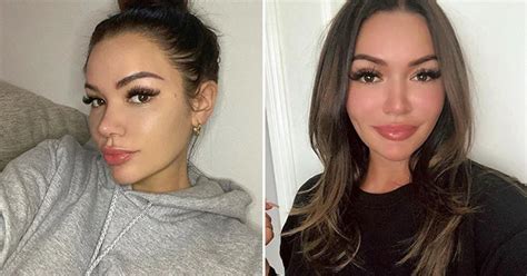 Surgery Genesis Lopez Complete Photos & Video Media #803