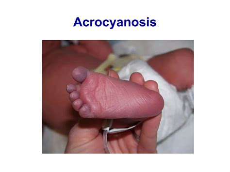 Neonatal examination | PPT