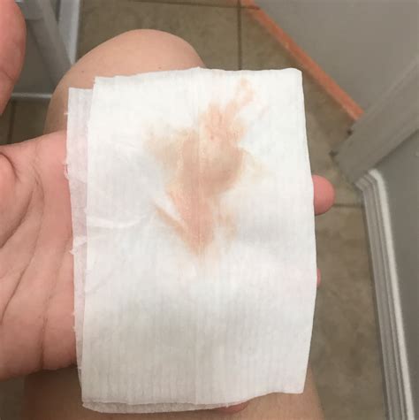 Implantation Bleeding Brown And Pink