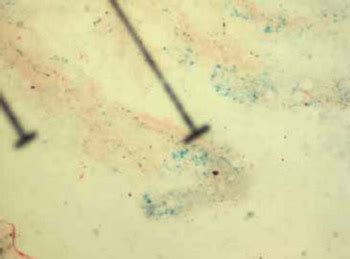 Vol. 9 No. 4 (2009) | Biomolecules and Biomedicine