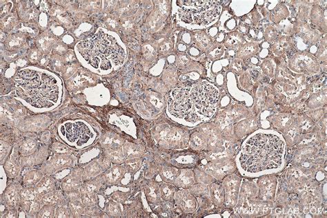 IHCeasy BGN/Biglycan Ready-To-Use IHC Kit KHC0480 | Proteintech