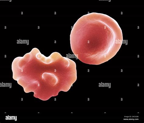 Red blood cells. Coloured scanning electron micrograph (SEM) of a ...