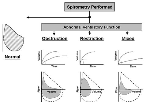 Image result for Spirometry Explained