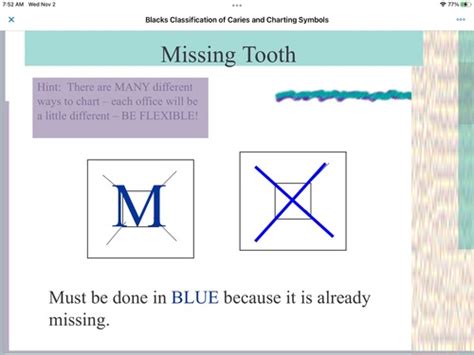 Image result for Blue Note Tutorial Dental