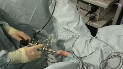 Image result for Turp Procedure Explained