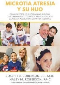 Microtia Atresia y Su Hijo: Buy Microtia Atresia y Su Hijo by Roberson ...
