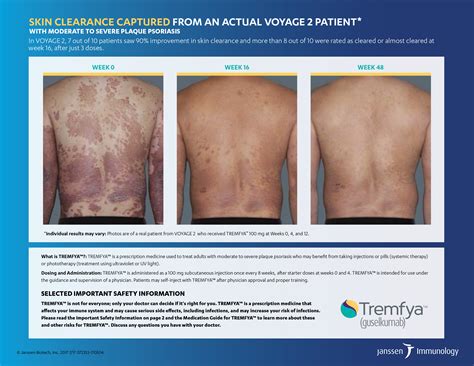 Tremfya Side Effects