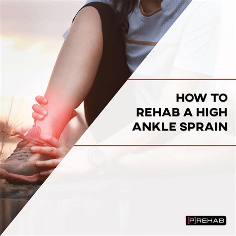 How To Rehab a High Ankle Sprain | [P]rehab