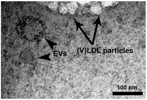 Lowering Low-Density Lipoprotein Particles in Plasma Using Dextran ...