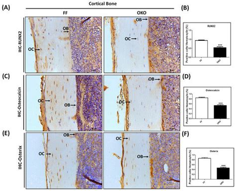 Ablation of Discoidin Domain Receptor 1 Provokes an Osteopenic ...