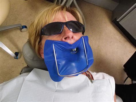 Dental Dam Demonstration