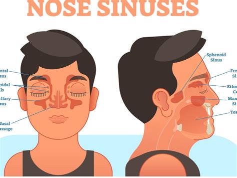 Using a Neti Pot 的图像结果