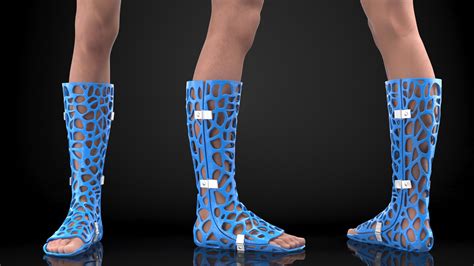 3D-Printed Orthopedic Casts On Limbs Collection 3D - TurboSquid 1920148