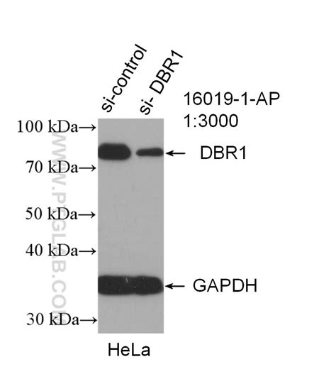 DBR1 Antikörper (16019-1-AP) | Proteintech