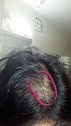 Buy USTRAA Hair Growth Vitalizer - 100ml - Boost hair growth, Prevents ...