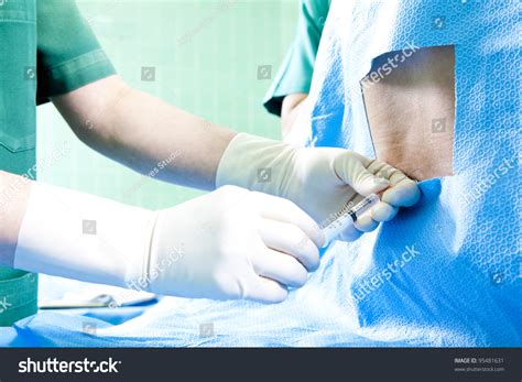 Injection Back Side 的图像结果