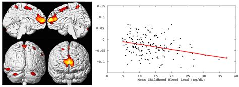 Pediatric Exposures to Neurotoxicants: A Review of Magnetic Resonance ...