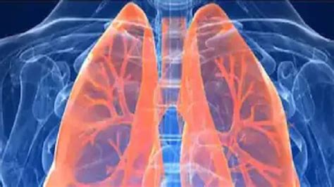 फेफड़े की बीमारी के मरीज की हालत कोरोना से बिगड़ी, लंग ट्रांसप्लांट ने ...