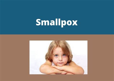 Smallpox » My Vision Of Health