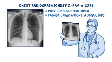 Image result for Chest X-Ray Tutorial