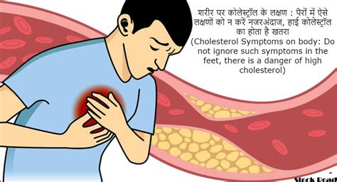 शरीर पर कोलेस्ट्रॉल के लक्षण : पैरों में ऐसे लक्षणों को न करें नजरअंदाज ...