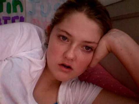 Image result for Exploding Zit Videos 2013