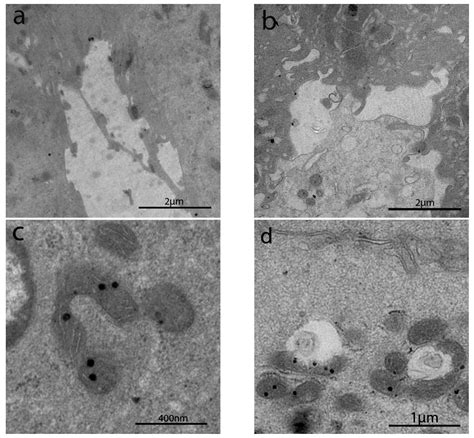 New Insights into Intestinal Permeability in Irritable Bowel Syndrome ...