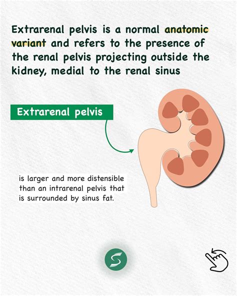 Ultrasound | Education | - It is not uncommon to see in practice the ...
