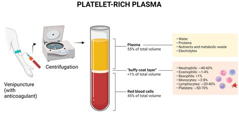 Regenerative Inflammation: The Mechanism Explained from the Perspective ...