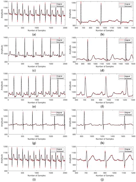 A Hybrid Approach to Enhanced Signal Denoising Using Data-Driven ...