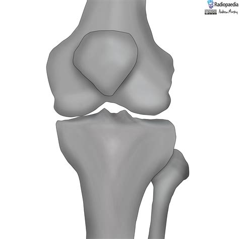 Radiopaedia - Drawing Bones of the knee joint - no labels | AnatomyTOOL