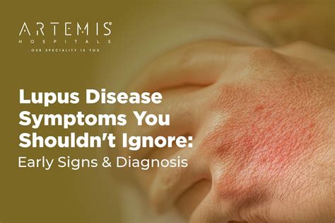 Understand Leptospirosis: Symptoms, Causes, Prevention & Treatment | Artemis Hospital