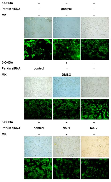 Maackiain Ameliorates 6-Hydroxydopamine and SNCA Pathologies by ...